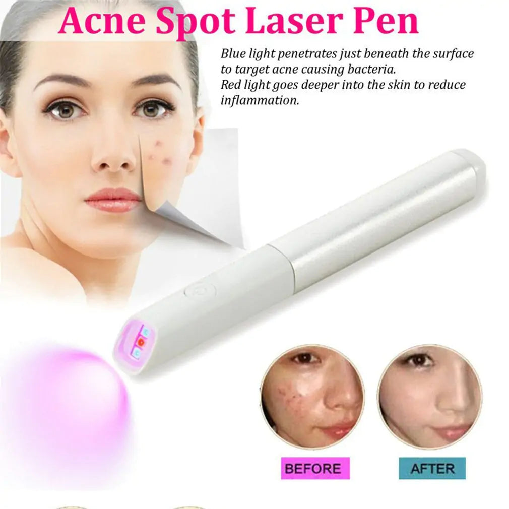 ClearGlow™ Acne Eraser